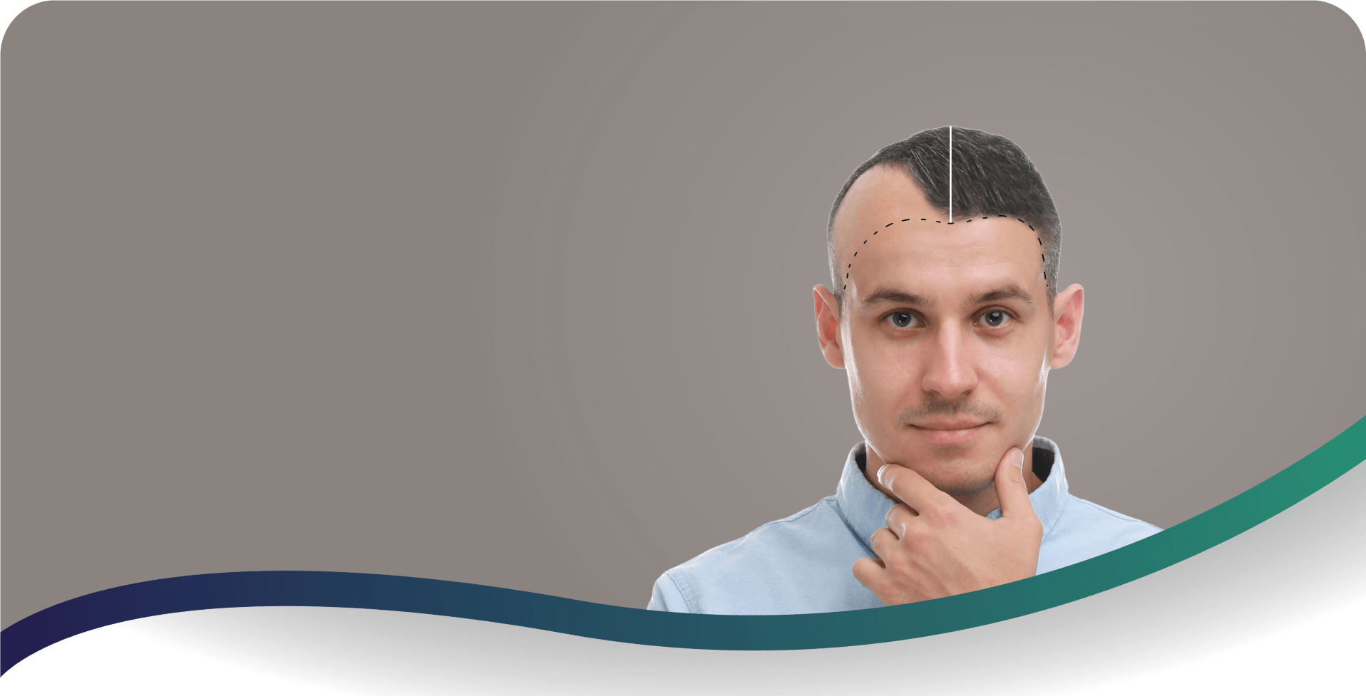 Hair transplantation treatment